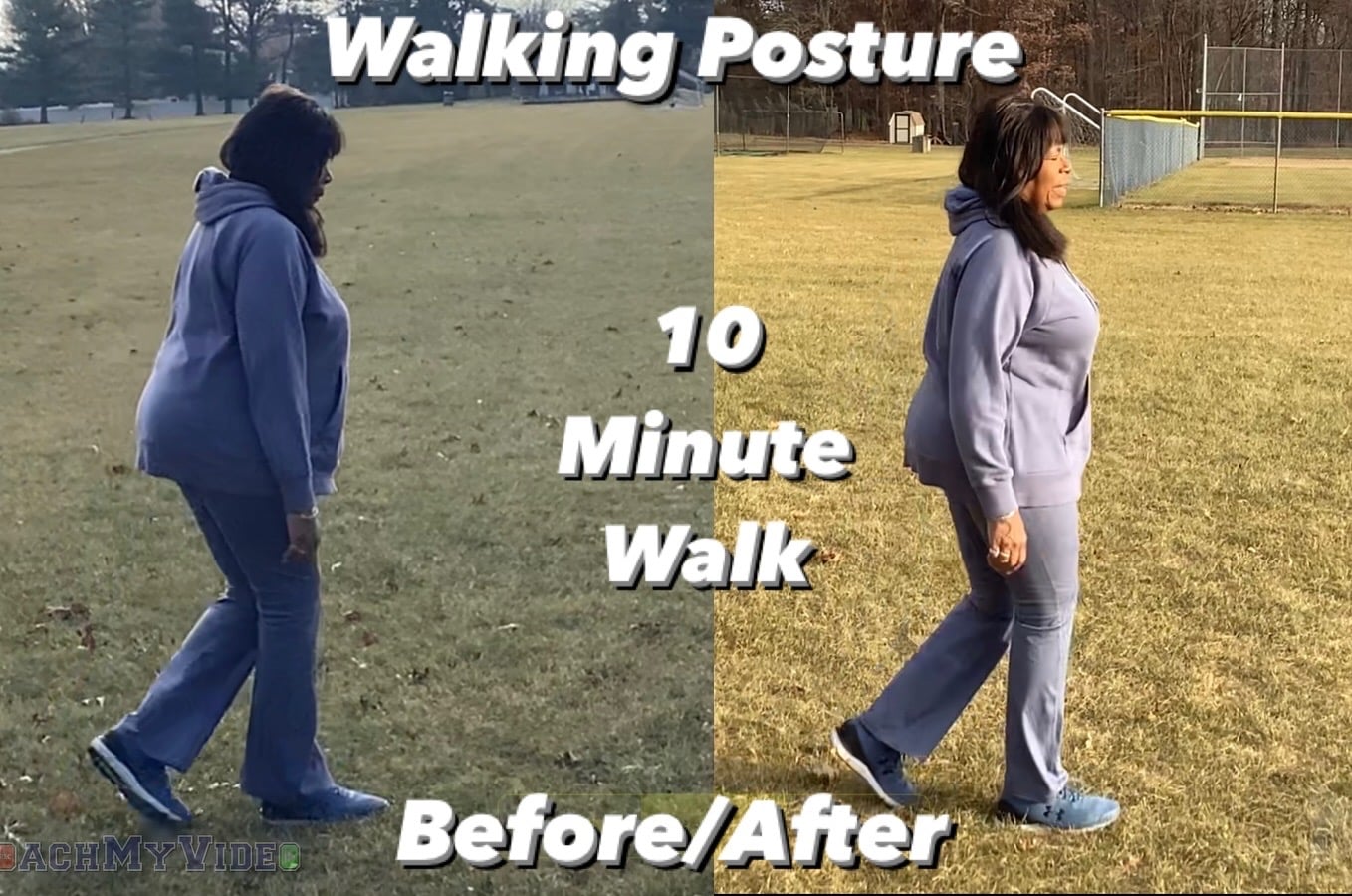 Posture Support Before and After